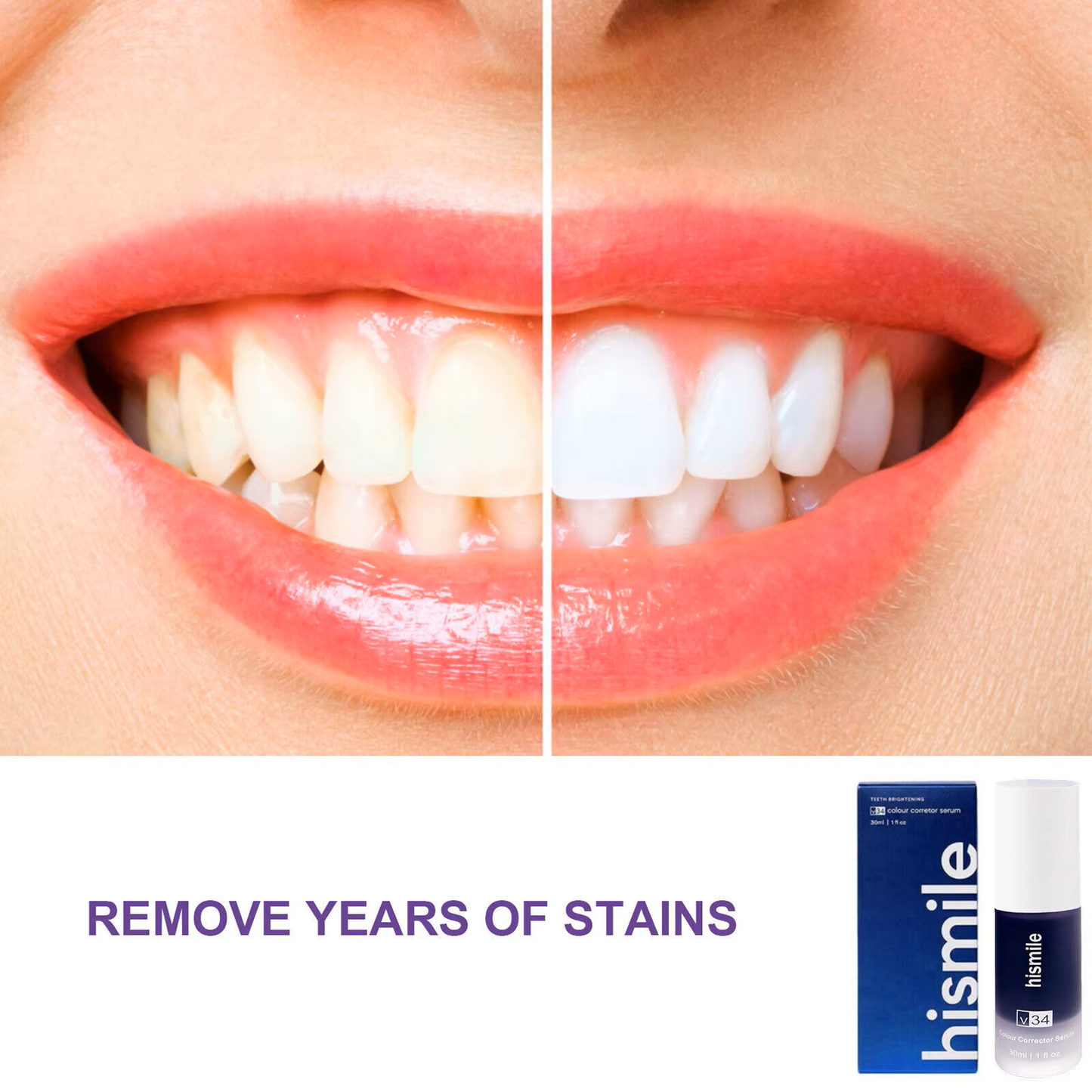 HISMILE™ Crema Dental Blanqueadora - Transforma Tu Sonrisa