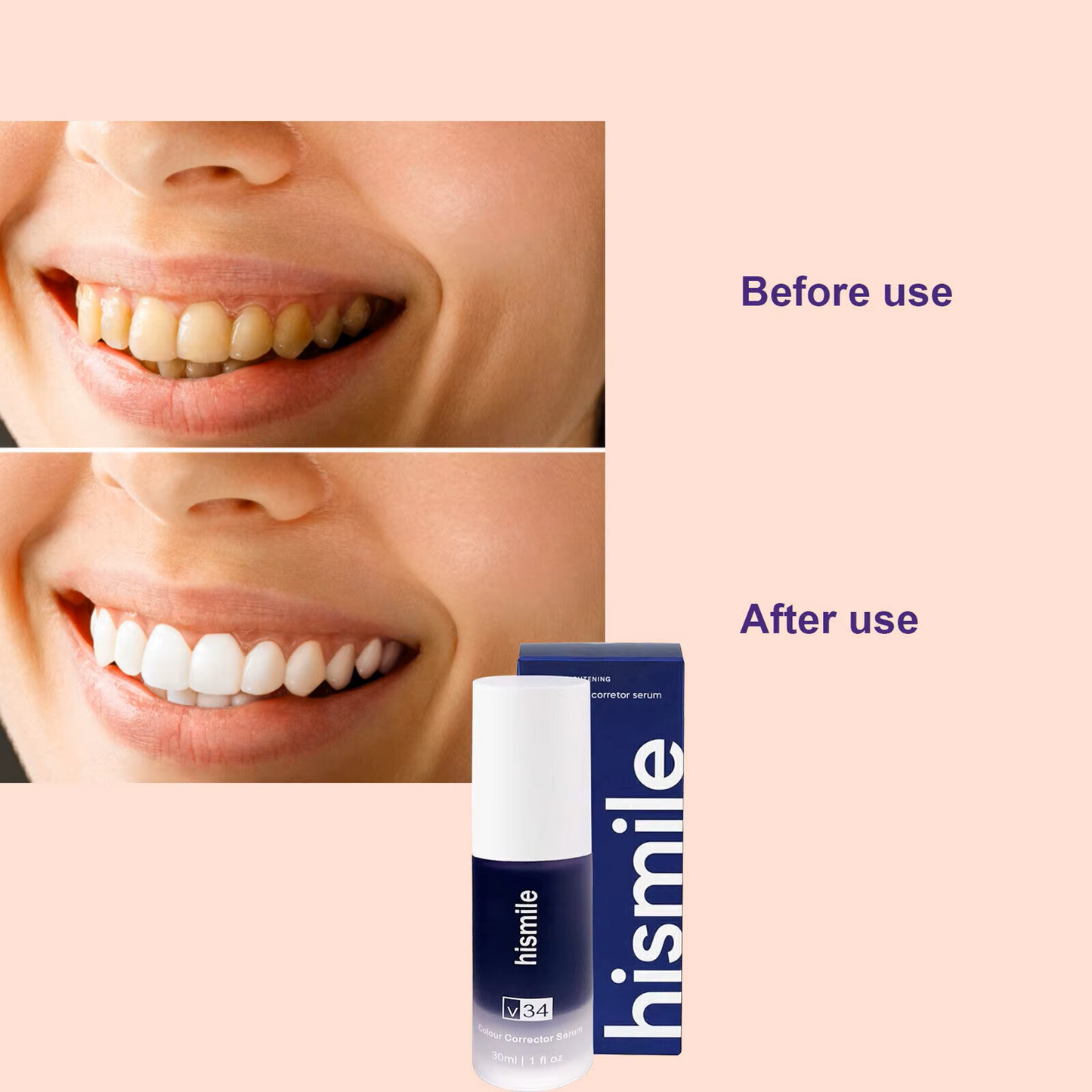 HISMILE™ Crema Dental Blanqueadora - Transforma Tu Sonrisa